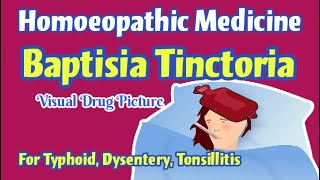 Baptisia Tinctoria 30 Homoeopathic Medicine Uses  Baptisia Mother Tincture  Baptisia Drug Picture [upl. by Fabrianne]