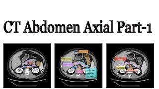 CT Scan of abdomen part 1 [upl. by Sito239]