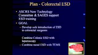 Endoscopic Submucosal with diagnostic Laparoscopy  PG MIS Colorectal Surgery [upl. by Wiese]