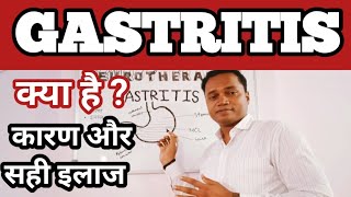 GASTRITIS क्या है  क्यों होता है  इसका सही इलाज  IBS treatmentgastritis treatmentgastritis [upl. by Ibbie]