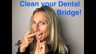 How to Clean Your Dental Bridge [upl. by Janessa]