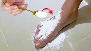 Put baking soda on my feet and you wont believe what happened [upl. by Stag]