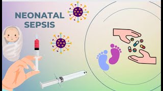 Neonatal Sepsis  Paediatrics [upl. by Eenalem450]