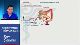 Gastroenterología  5 Hemorragia Digestiva Baja [upl. by Artemisia592]