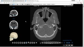 Tomografía Computada de Cabeza para Anatomía Parte 1 [upl. by Nnauol626]