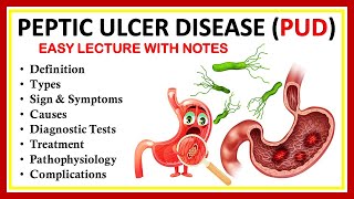 Peptic Ulcer Disease PUD Definition Types Sign amp Symptoms Causes Diagnostic Tests Treatment [upl. by Blondell618]