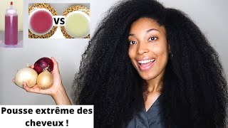 UTILISEZ LE JUS DOIGNON POUR UNE POUSSE EXTRÊME DE VOS CHEVEUX  Oignon Jaune VS Oignon Rouge [upl. by Trina]