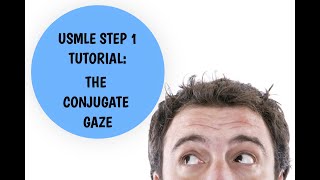 USMLE Step 1 Tutorial  Conjugate Gaze Explained [upl. by Okimuk701]