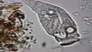 Rotifer at x600 under Celestron PentaView Digital [upl. by Mcgray]