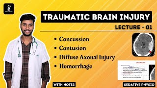 Traumatic Brain Injury  Types of Hemorrhage  Sedative Physio braininjury [upl. by Terag453]