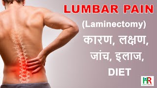 Lumbar Laminectomy in hindi What is lumbar laminectomy prevention after lumbar laminectomy [upl. by Arakihc]