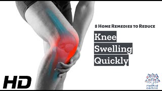 Knee Swelling Begone 8 Effective Home Remedies You Can Try Today [upl. by Sollie864]