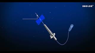 Unolok Infusion Set – Enables smooth IV infusion of medication [upl. by Ednutabab]