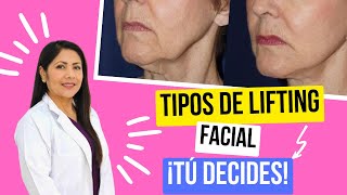 TIPOS de Lifting Facial 👀 CIRUGÍA PLÁSTICA Para Rejuvenecer Rostro 👁️ Dra LIZBETH ZUÑIGA [upl. by Hendry]