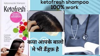 ketofresh shampoo 2024 Honest Review [upl. by Nibram]