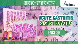 Acute Gastritis amp Gastropathy  Morphology  English [upl. by Gagliano]