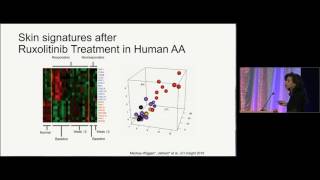 Hair Raising Experiences JAK Inhibitors in Alopecia [upl. by Hsirt]