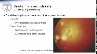 Candida Systemic Candidiasis [upl. by Einal592]