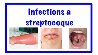 🔵infection à streptocoque 👹 streptococcies [upl. by Ferreby]