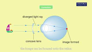 Animation 155 Short sight and long sight [upl. by Holds968]