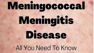 Meningococcal meningitis  social pharmacy 1st year d pharmacy pharmacist biology pharmacy neet [upl. by Emaj]