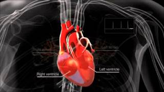 What is atrial fibrillation [upl. by Husch107]