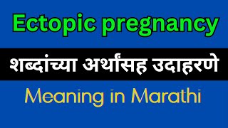 Ectopic pregnancy Meaning In Marathi  Ectopic pregnancy explained in Marathi [upl. by Arihk]