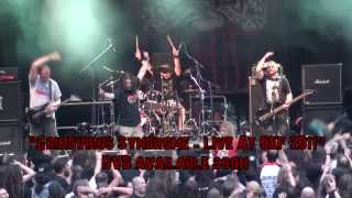 Squash Bowels  Grindvirus Syndrome  Live At OEF 2011  DVD trailer HD [upl. by Hatfield]