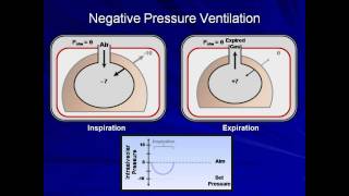 An Introduction to Mechanical Ventilation Mechanical Ventilation  Lecture 1 [upl. by Shirlie]