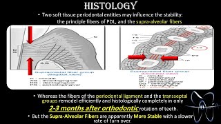 Circumferential Supracrestal Fiberotomy  CSF  DrAwfa [upl. by Evangelina]