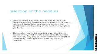 Acupuncturemethod usesits mechanism of actionrisk and side effects [upl. by Elvis]