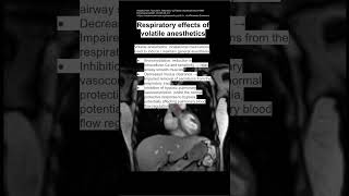 Respiratory effects of volatile anesthetics [upl. by Mascia]