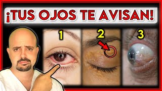 7 SEÑALES en tus OJOS que indican un PROBLEMA de SALUD  ¡NO los IGNORES [upl. by Gnav]