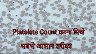 Platelet count under microscope  Platelets Count करना सिखे [upl. by Ahsykal]