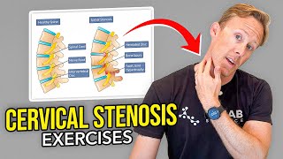 5 Exercises for Cervical Stenosis Arm Nerve Pain [upl. by Avot]