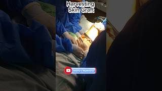 Harvesting skin graft Open wound Management  medical surgicalskills plasticsurgery [upl. by Hoxsie24]