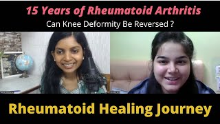 Can knee Deformity be Reversed   and her RA Medication Experience [upl. by Bbor221]