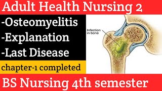 osteomyelitis causes symptoms diagnosis treatment amp pathology in Urdu and Hindi Disorderlast [upl. by Keri]