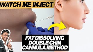 Fat Dissolving Injections For Double Chin Cannula HowTo [upl. by Middle]