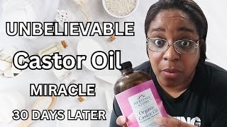 I Used CASTOR OIL For 30 DAYS And THIS HAPPENED [upl. by Etiuqal]