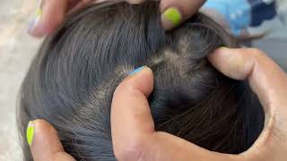 ASMR Lice and Nits Removal for Ultimate Scalp Check  Satisfying [upl. by Takakura]