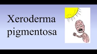 Xeroderma pigmentosum XP [upl. by Joshua]