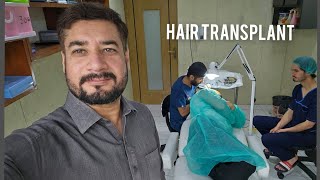 Hair Transplant  12 hours Operation  Peshawar [upl. by Trudnak698]