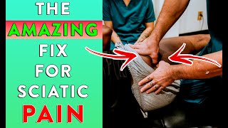 98 Sciatica Pain Improvement in Using THIS SECRET Method [upl. by Ataliah534]