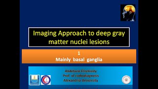 basal ganglia lesions 1 [upl. by Gale]