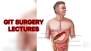 GIT SURGERY LECTURES SPLEEN part 1 Spleenectomy surgerylectures spleen git [upl. by Ayoras429]