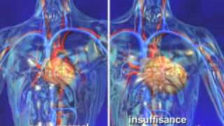 Insuffisance cardiaque dépistage de l’insuffisance cardiaque en vidéo santé 3D [upl. by Stedman539]