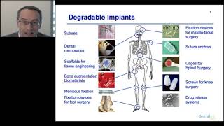 Beta Tricalcium Phosphate Composites in Bone Regeneration [upl. by Madeline]