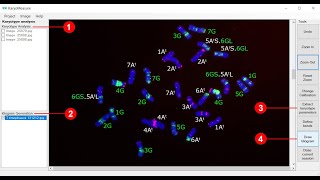 Karyotype analysis using KaryoMeasure [upl. by Nitsrik52]