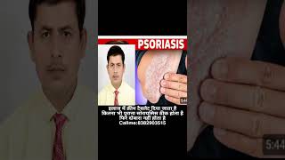 Psoriasis kya hai [upl. by Traggat]